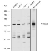 Solarbio K110557P Anti-ATP2A2 Polyclonal Antibody