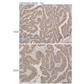 Solarbio K110545P Anti-ACP1 Polyclonal Antibody