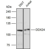 Solarbio K111299P Anti-DDX24 Polyclonal Antibody