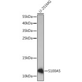 Solarbio K009986P Anti-S100A5 Polyclonal Antibody