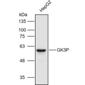 Solarbio K110915P Anti-GK3P Polyclonal Antibody
