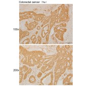 Solarbio K111252P Anti-MRPL10 Polyclonal Antibody