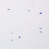 Solarbio G2571 精子形态学染色试剂盒(巴氏法)