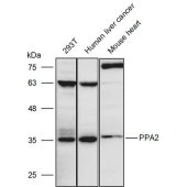 Solarbio K111424P Anti-PPA2 Polyclonal Antibody
