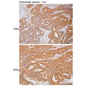 Solarbio K111799P Anti-RPAP3 Polyclonal Antibody