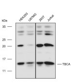 Solarbio K110581P Anti-TBCA Polyclonal Antibody