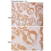 Solarbio K111117P Anti-RNF19A Polyclonal Antibody
