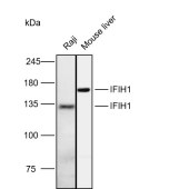 Solarbio K112121P Anti-IFIH1 Polyclonal Antibody