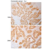 Solarbio K110900P Anti-RIN1 Polyclonal Antibody