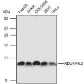 Solarbio K110926P Anti-NDUFA4L2 Polyclonal Antibody