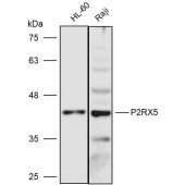 Solarbio K111459P Anti-P2RX5 Polyclonal Antibody