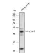 Solarbio K111034P Anti-NOTUM Polyclonal Antibody