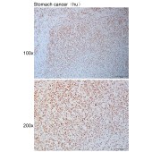Solarbio K111125P Anti-CDK11A/CDK11B Polyclonal Antibody