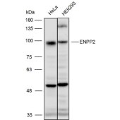 Solarbio K111498P Anti-ENPP2 Polyclonal Antibody