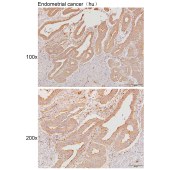 Solarbio K111291P Anti-BCAR3 Polyclonal Antibody