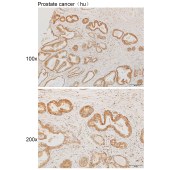 Solarbio K111910P Anti-NEDD9 Polyclonal Antibody