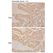Solarbio K111254P Anti-AHSA1 Polyclonal Antibody