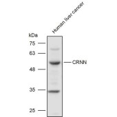 Solarbio K111426P Anti-CRNN Polyclonal Antibody