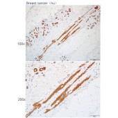 Solarbio K112113P Anti-PADI2 Polyclonal Antibody
