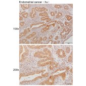 Solarbio K111245P Anti-CEP20 Polyclonal Antibody