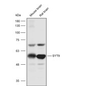 Solarbio K111609P Anti-SYT9 Polyclonal Antibody