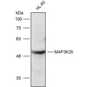 Solarbio K111491P Anti-MAP3K20 Polyclonal Antibody