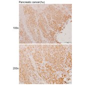 Solarbio K110955P Anti-CPA1 Polyclonal Antibody