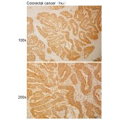 Solarbio K110980P Anti-GUCY1B1 Polyclonal Antibody