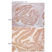 Solarbio K110602P Anti-FBXO9 Polyclonal Antibody