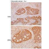 Solarbio K111662P Anti-LRR1 Polyclonal Antibody