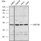 Solarbio K111100P Anti-ZNF785 Polyclonal Antibody
