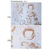 Solarbio K111112P Anti-CDH22 Polyclonal Antibody