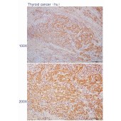 Solarbio K110609P Anti-HSD3B7 Polyclonal Antibody