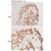 Solarbio K111474P Anti-BCAP31 Polyclonal Antibody