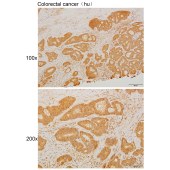Solarbio K111409P Anti-EXOC4 Polyclonal Antibody