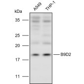 Solarbio K110914P Anti-B9D2 Polyclonal Antibody