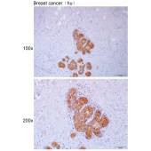 Solarbio K112123P Anti-HYAL1 Polyclonal Antibody