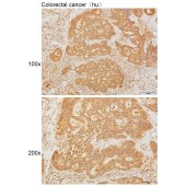 Solarbio K111633P Anti-DGKD Polyclonal Antibody