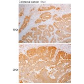 Solarbio K110905P Anti-MARK2 Polyclonal Antibody