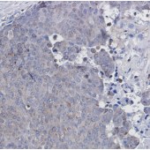 Solarbio K009921P Anti-ATGL Polyclonal Antibody