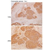 Solarbio K111693P Anti-MDP1 Polyclonal Antibody