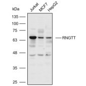 Solarbio K110578P Anti-RNGTT Polyclonal Antibody