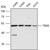 Solarbio K111405P Anti-TBX6 Polyclonal Antibody