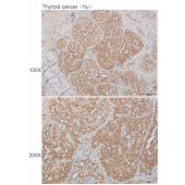Solarbio K110552P Anti-CAMKK1 Polyclonal Antibody
