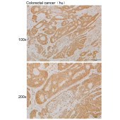 Solarbio K111887P Anti-CCP110 Polyclonal Antibody