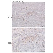 Solarbio K111606P Anti-IGHM Polyclonal Antibody