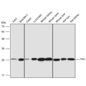 Solarbio K111441P Anti-TPI1 Polyclonal Antibody