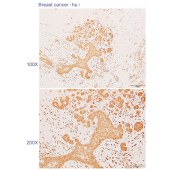 Solarbio K110712P Anti-AP5Z1 Polyclonal Antibody