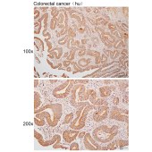 Solarbio K111303P Anti-TTK Polyclonal Antibody