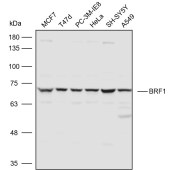 Solarbio K110607P Anti-BRF1 Polyclonal Antibody